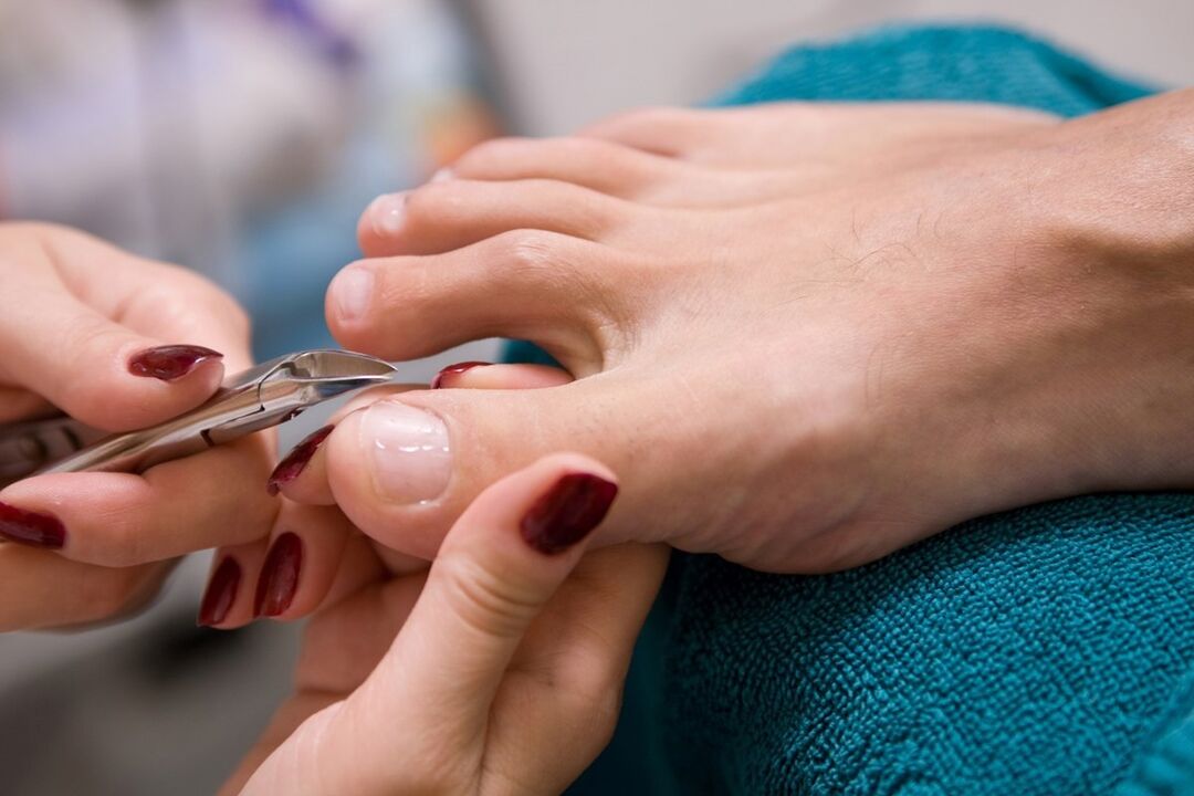 pedicure sposobem na zarażenie grzybicą paznokci