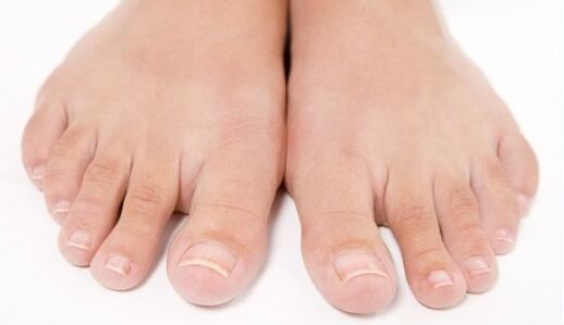 zdrowe stopy po kuracji przeciwgrzybiczej
