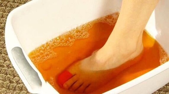 Kąpiel jodowa przeciw grzybicy stóp